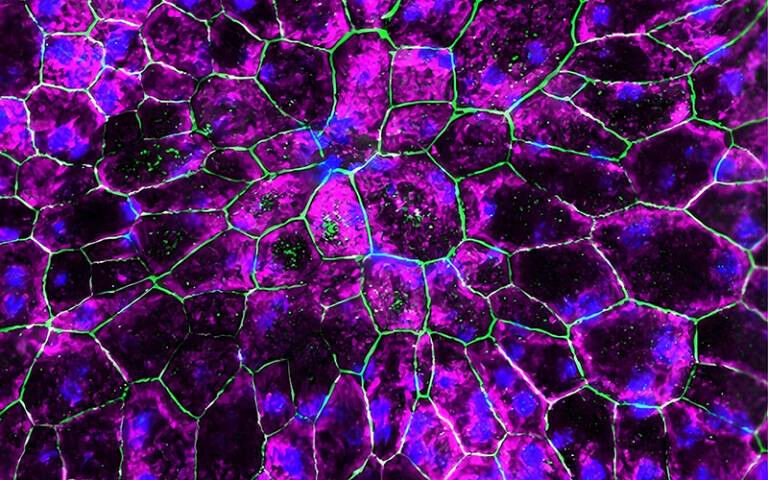 Células do epitélio pigmentar da retina resgatadas após terapia genética IRAK-M - Frente c