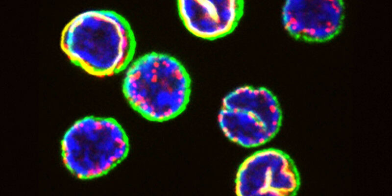 Células T recentemente isoladas do sangue de um doador humano saudável.  Componente nuclear