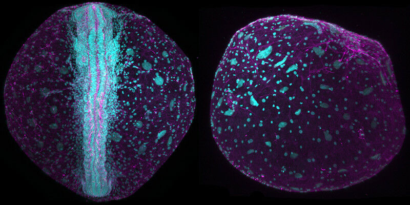 Embriões de Killifish sob um microscópio de fluorescência.  Deixado com um eixo desenvolvido, r