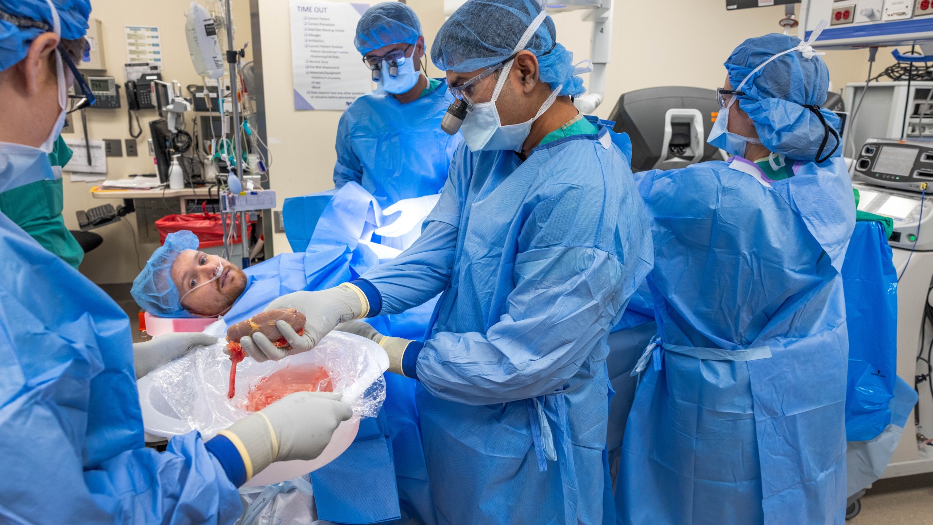 Quatro profissionais médicos são mostrados na sala de cirurgia cercando um paciente deitado em uma cama.  Todos usam batas cirúrgicas azuis, máscaras faciais e redes para o cabelo.  Um cirurgião no centro da imagem está se afastando do paciente enquanto coloca um rim em uma tigela segurada por outro profissional médico.