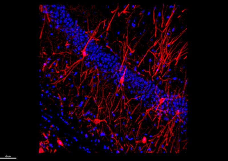 Imagem mostrando o aumento neuronal do receptor A2A (em vermelho) no quadril do camundongo