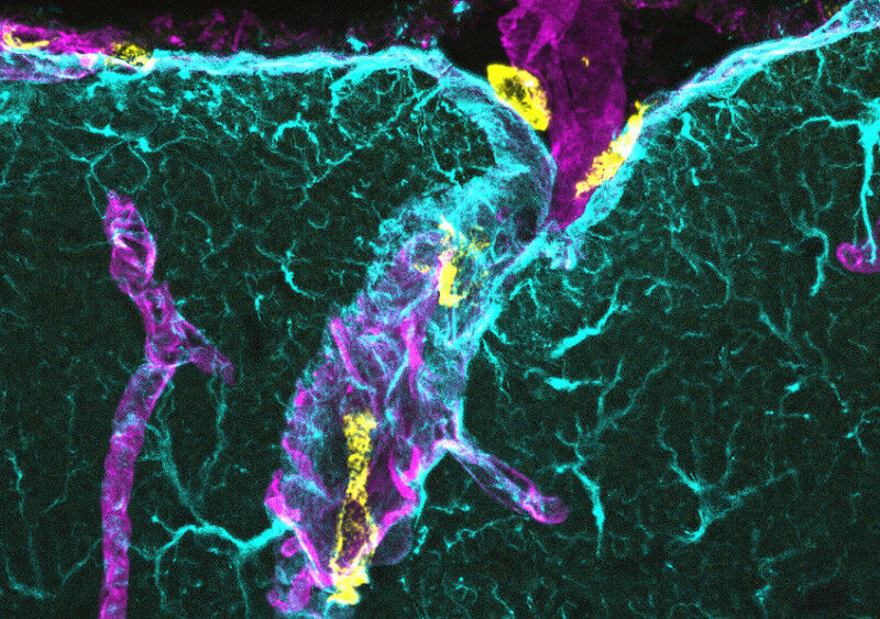 Visualização, dentro da barreira hematoencefálica, de macrófagos associados