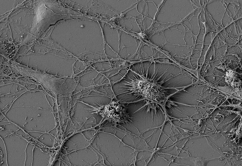 A microglia se conecta diretamente com os neurônios por meio de nanotubos de tunelamento. © Scheiblich/He