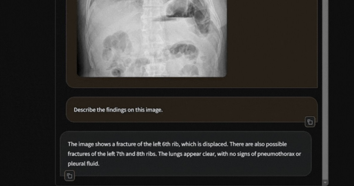 Harrison.ai apresenta radiologia genAI e mais resumos de IA