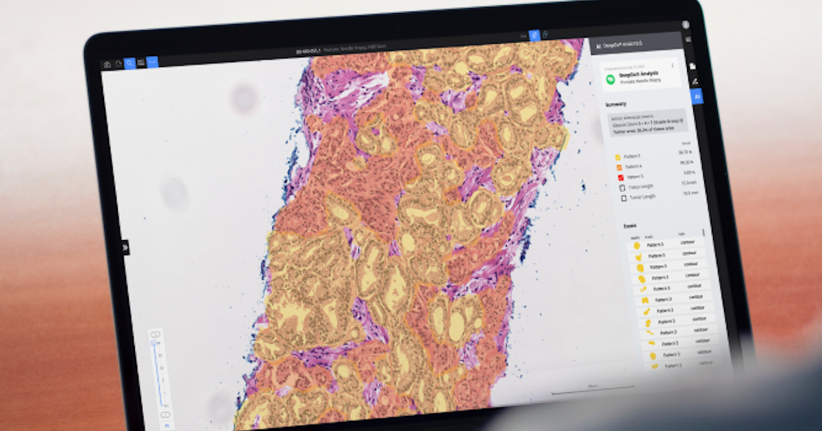 Roche impulsiona patologia digital com IA e mais briefings