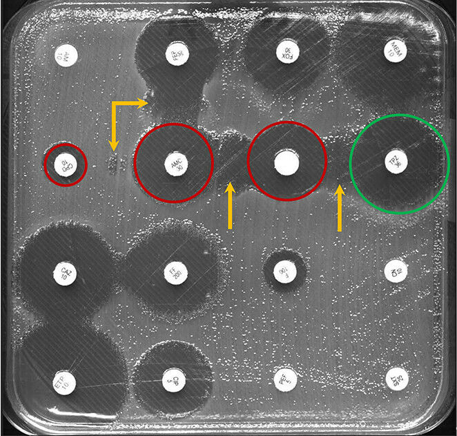 Teste de difusão em disco Kirby-Bauer de bactérias intestinais: folhas de papel embebidas em antibi