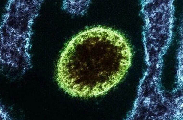 Vírus Nipah preocupa na Ásia