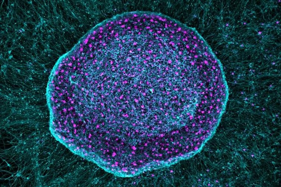 Adeus analgésicos? Nova “esponja” trava o aparecimento da dor